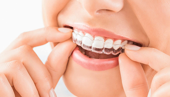 Los tratamientos de ortodoncia están diseñados para mejorar tu estética dental
