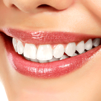 El blanqueamiento dental forma parte de nuestros tratamientos